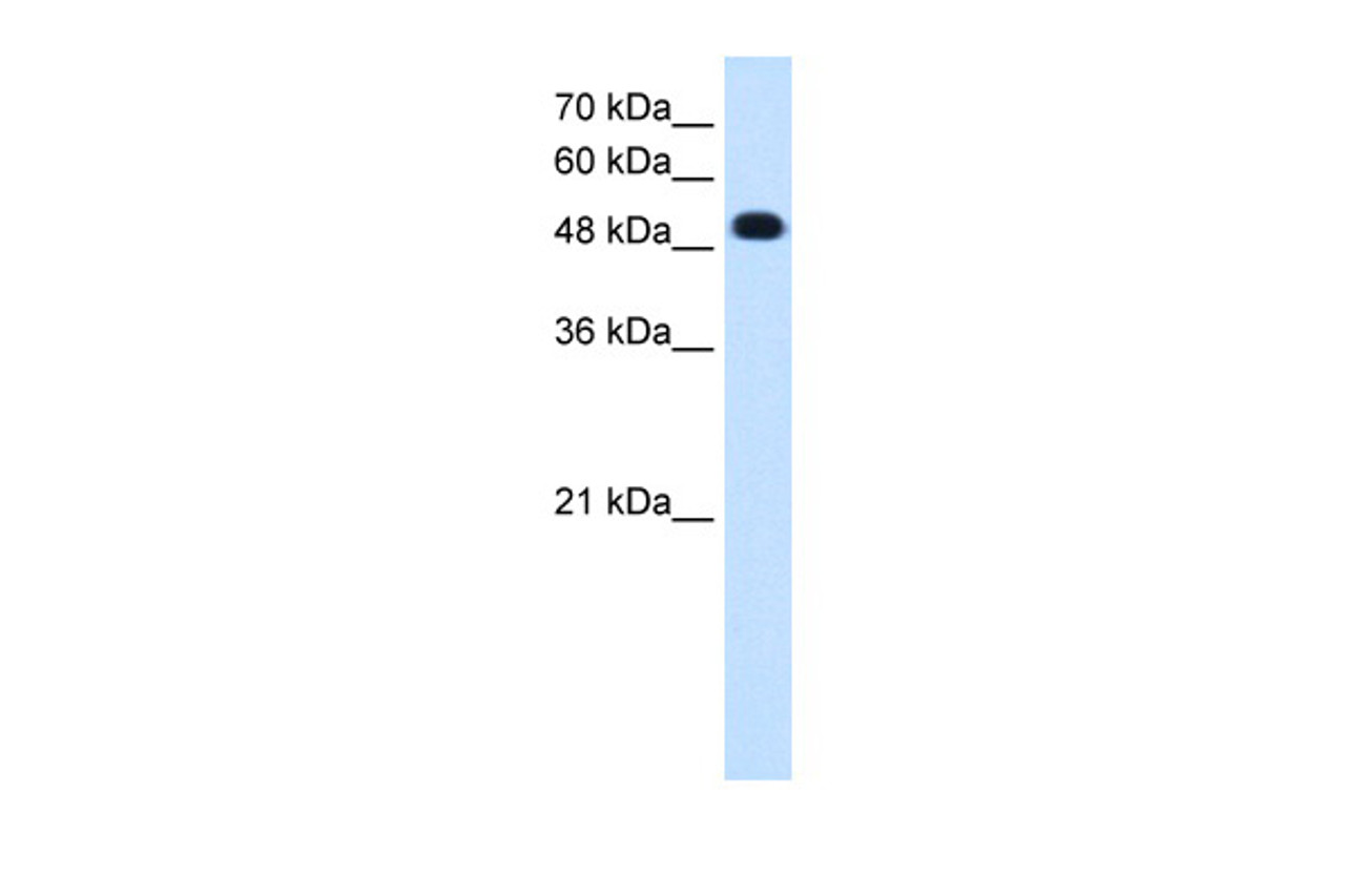 Antibody used in WB on Human Jurkat 0.2-1 ug/ml.