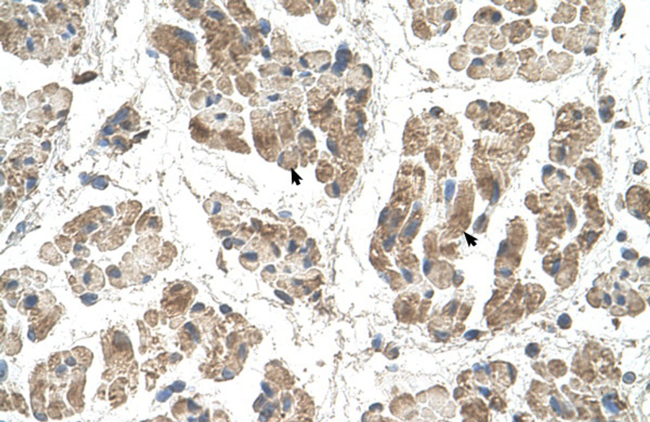 Antibody used in IHC on Human Muscle.