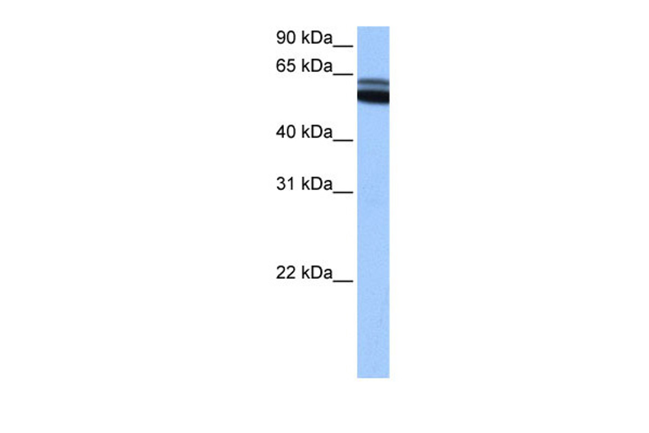 Antibody used in WB on Human brain at 0.2-1 ug/ml.