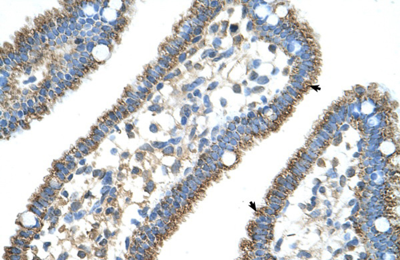 Antibody used in IHC on Human Intestine.