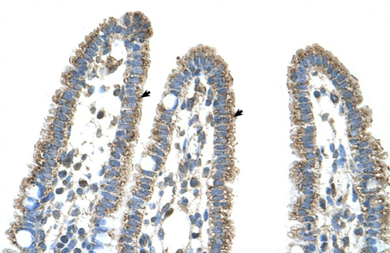 Antibody used in IHC on Human Intestine.