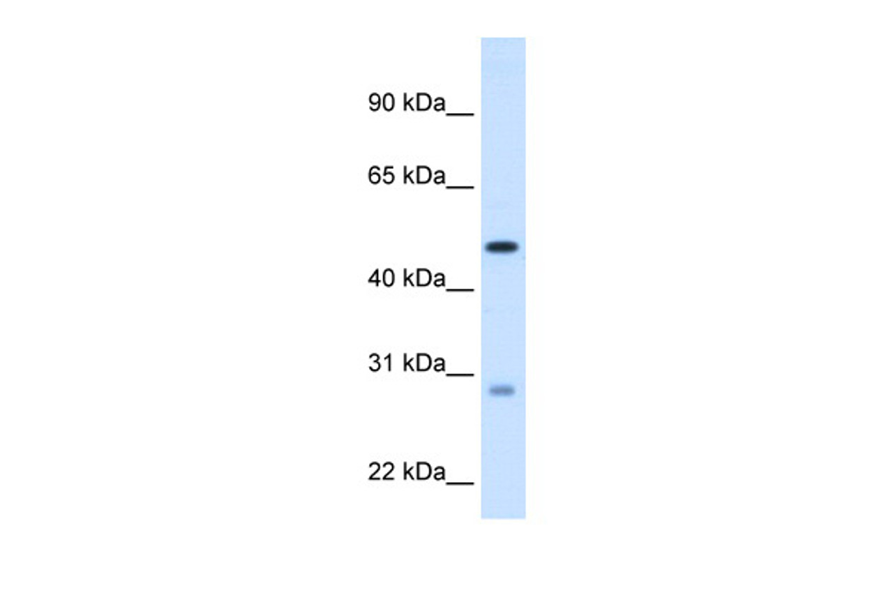 Antibody used in WB on Human Liver at 1.25 ug/ml.