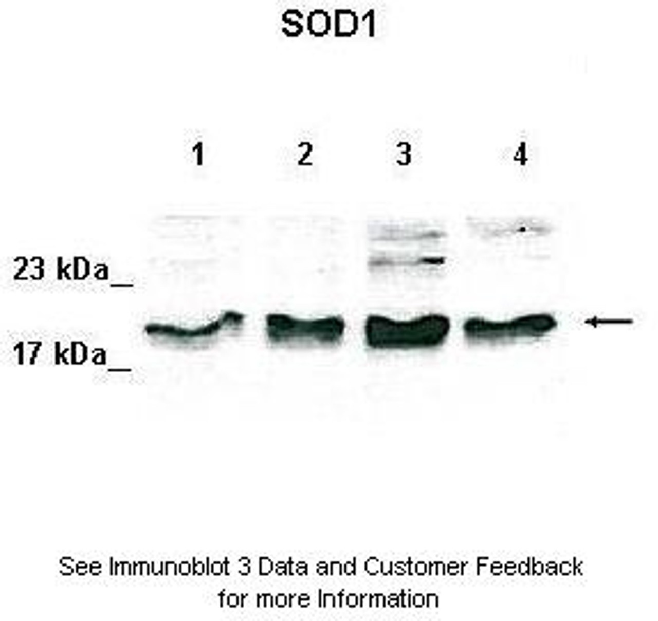 Antibody used in WB on Human cell lines at: 1:500 (Lane 1: 50ug HeLa lysate, Lane 2: 50ug 293T lysate, Lane 3: 50ug K562 lysate, Lane 4: 50ug MDA-MB-231 lysate) .