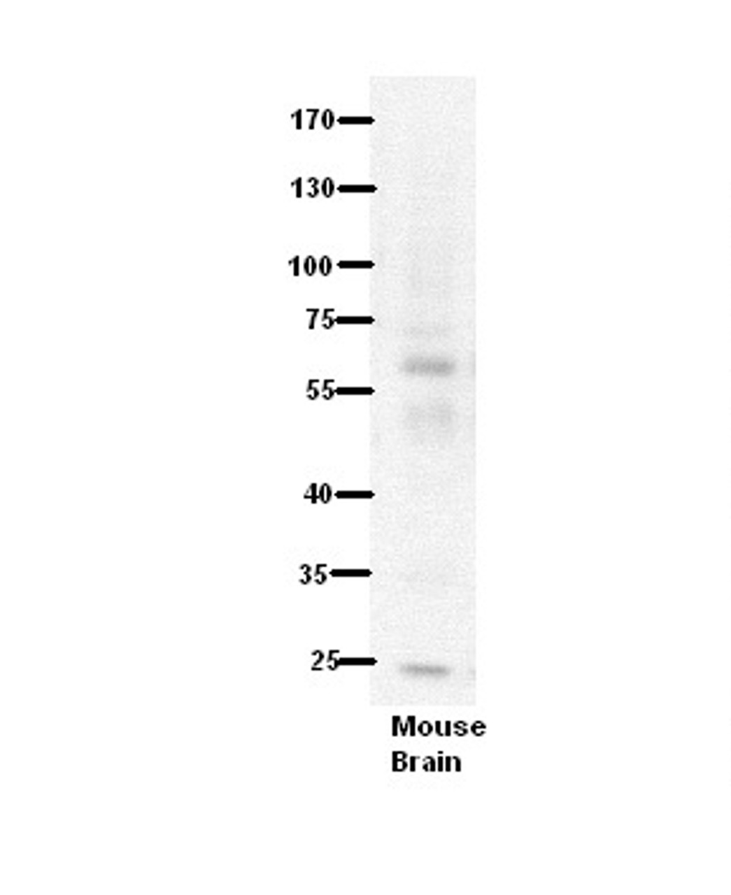 Antibody used in WB on Mouse Brain at 1:500.