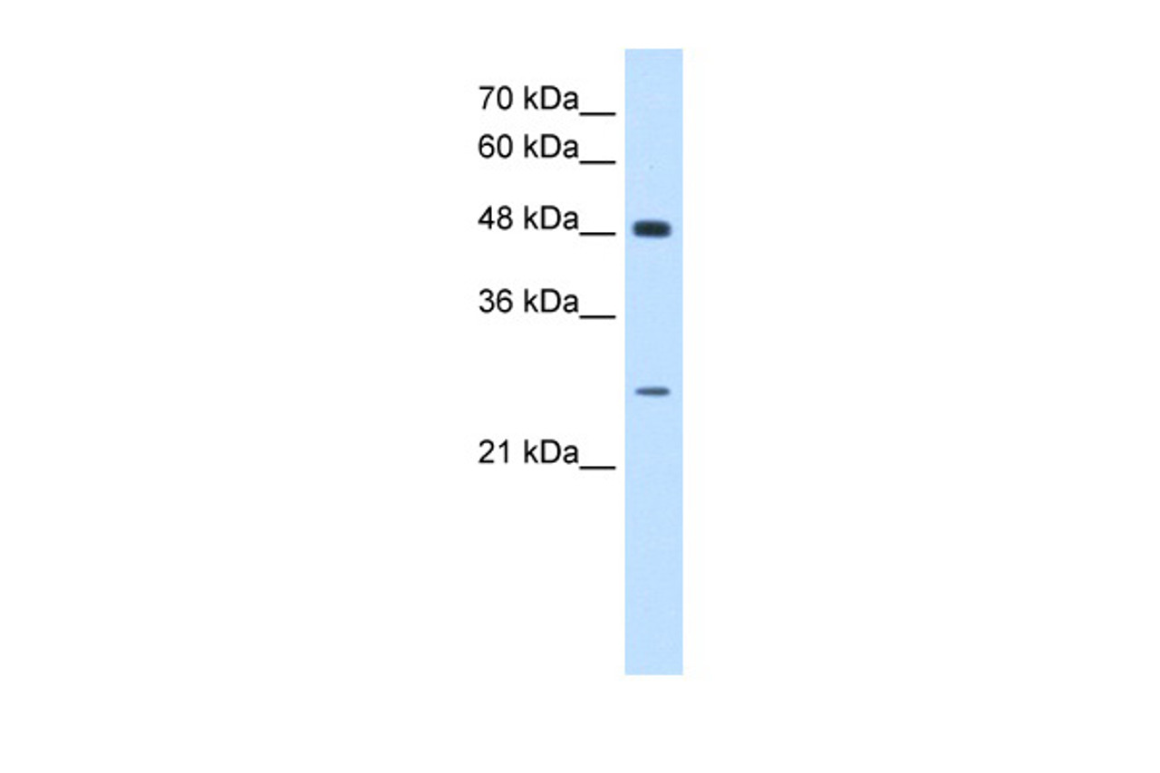 Antibody used in WB on Human HepG2 at 0.2-1 ug/ml.