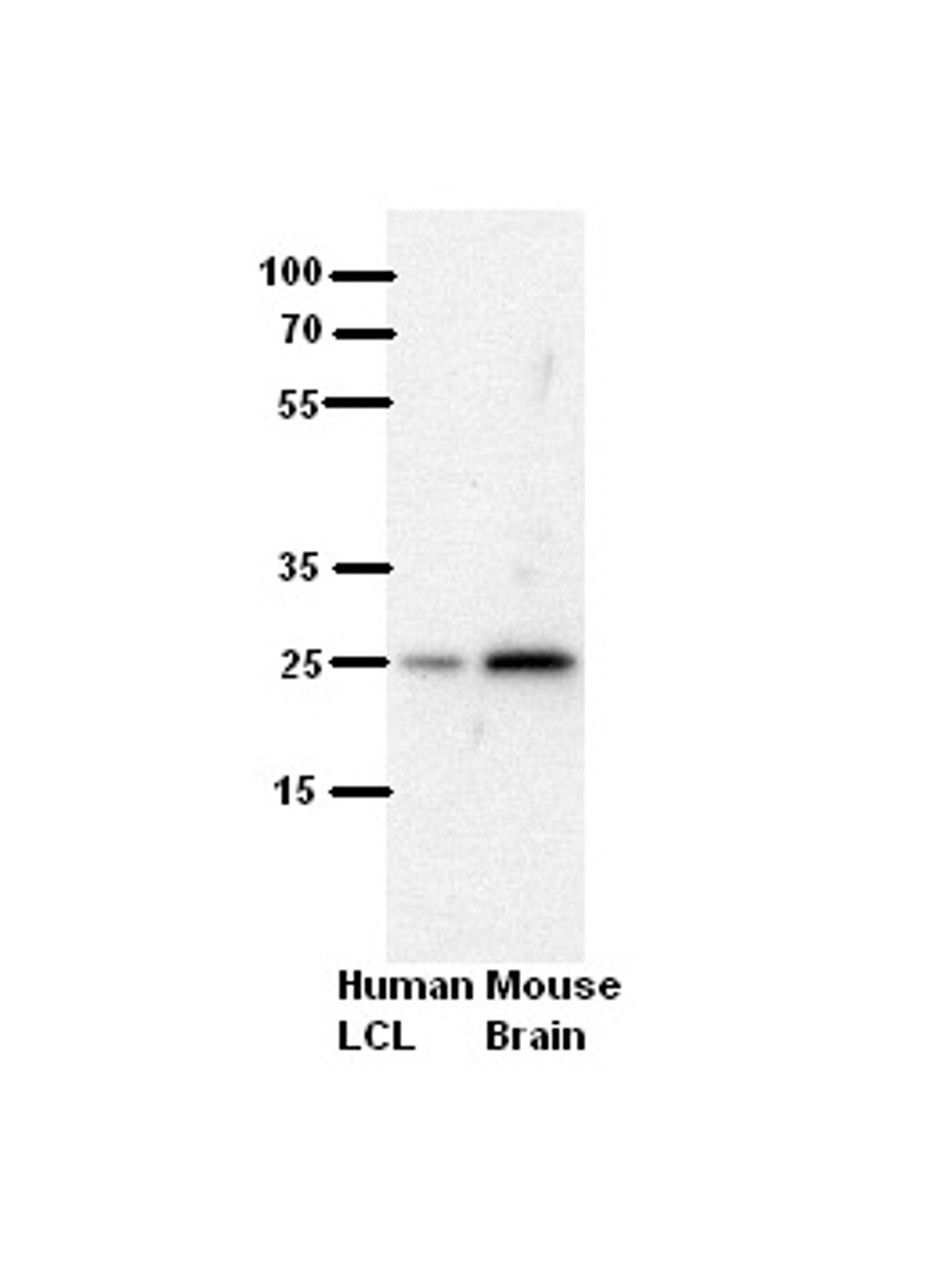 Antibody used in WB on Human, Mouse at 1:500.