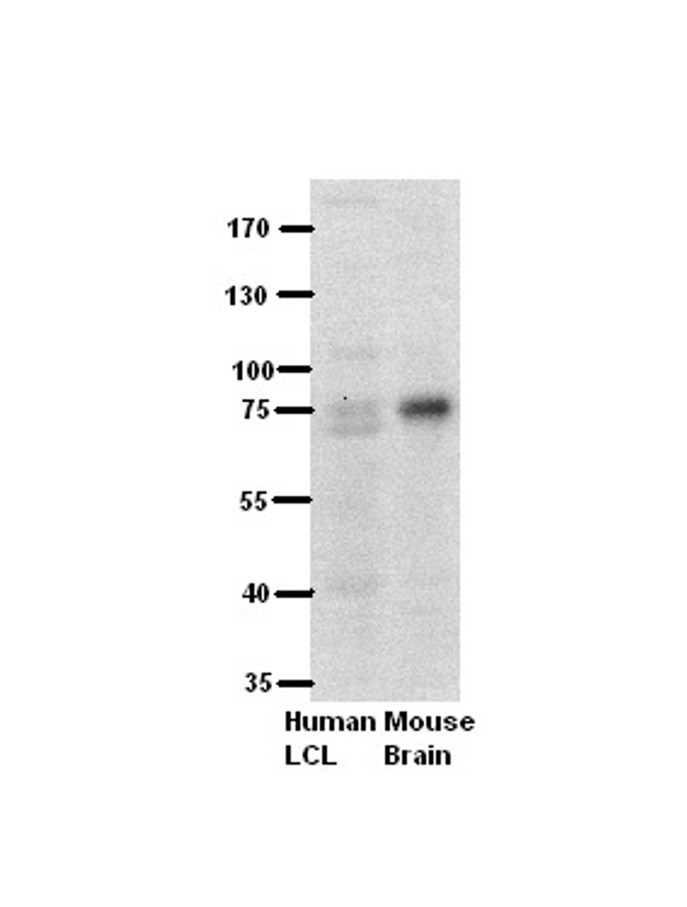 Antibody used in WB on Human, Mouse at 1:500.