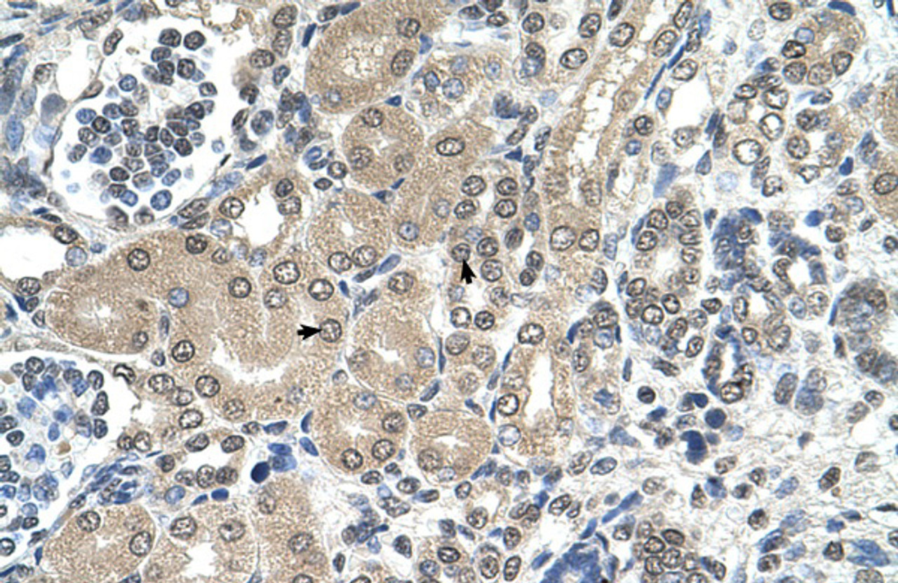 Antibody used in IHC on Human kidney.