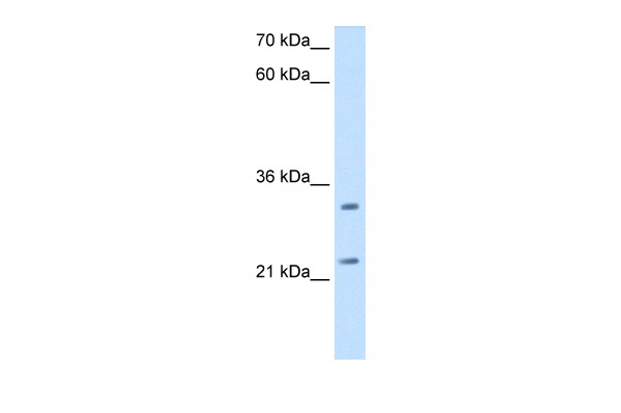 Antibody used in WB on Human HepG2 at 2.5 ug/ml.