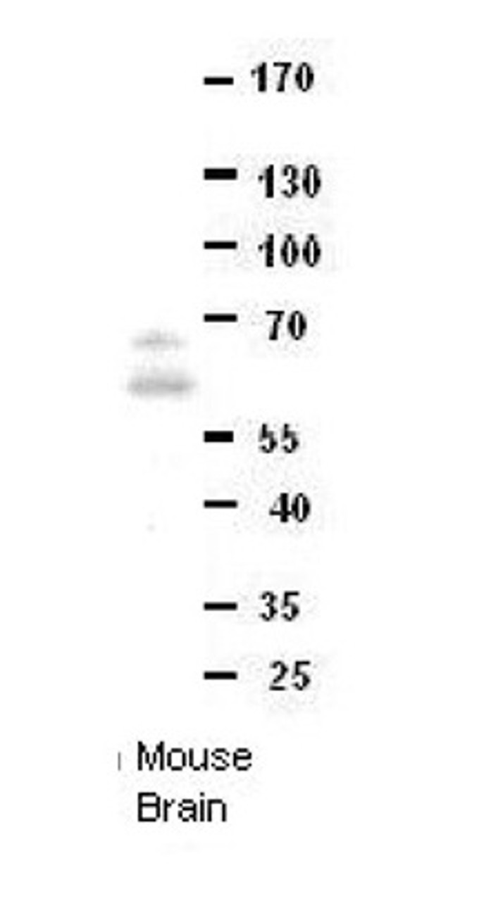 Antibody used in WB on Mouse brains at 1:1000.