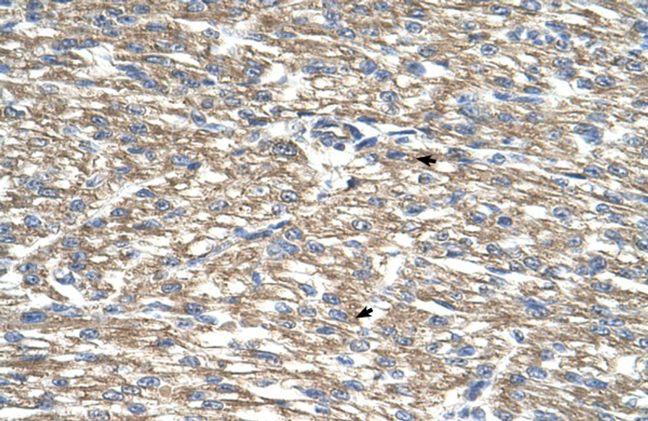 Antibody used in IHC on Human Heart.