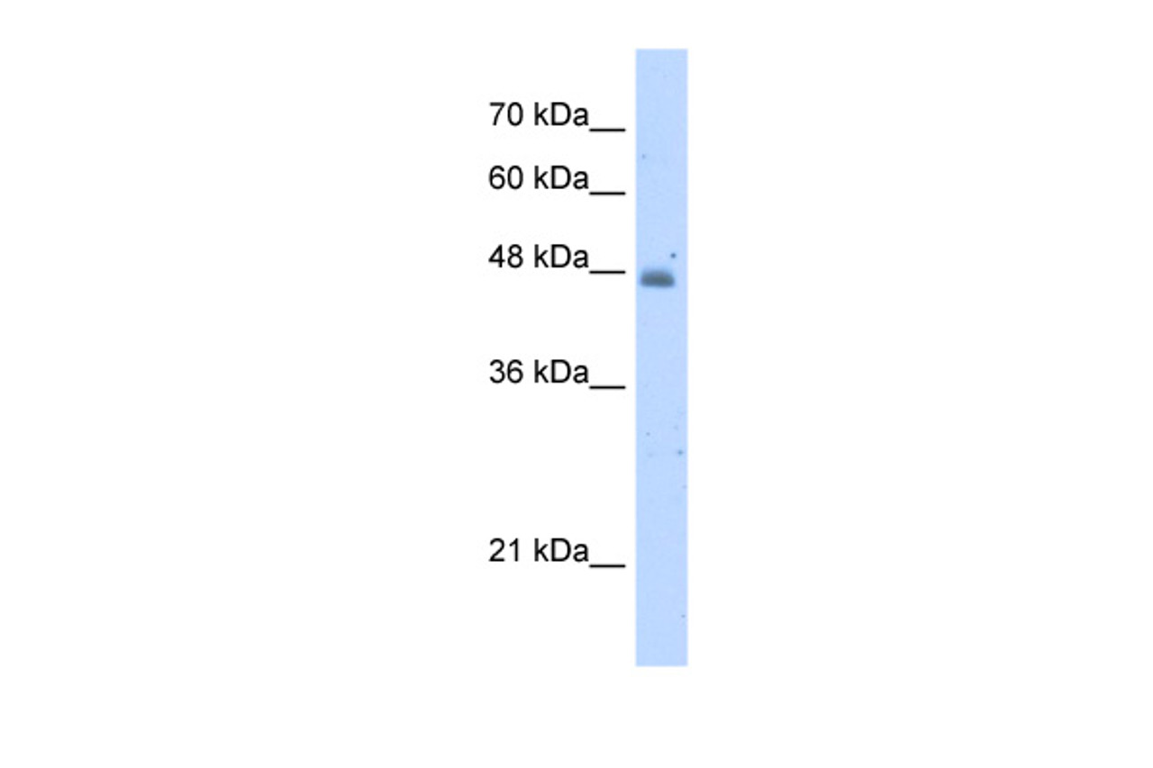 Antibody used in WB on Human HepG2 at 5.0 ug/ml.