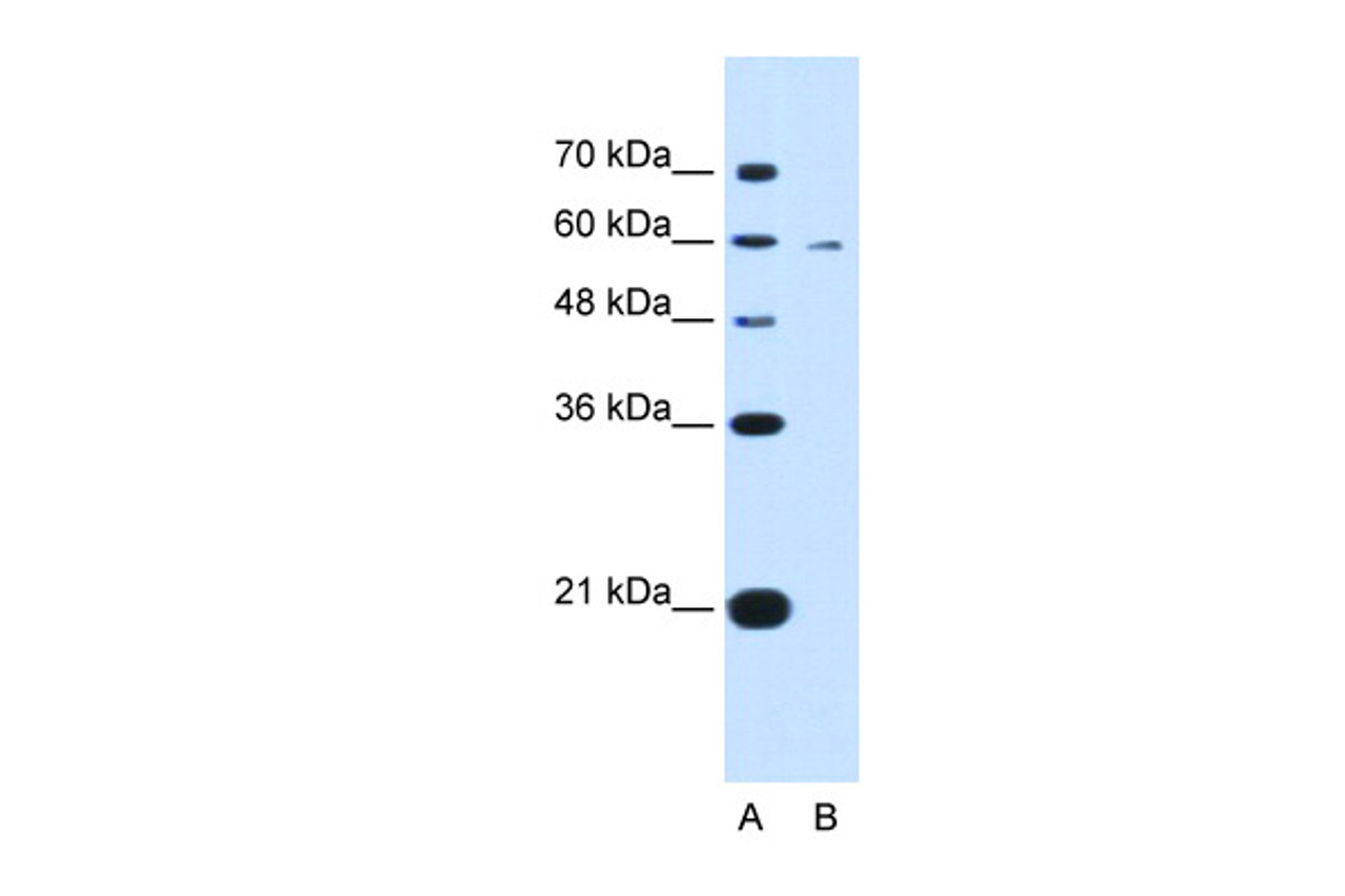 Antibody used in WB on Human HepG2 at 0.2-1 ug/ml.