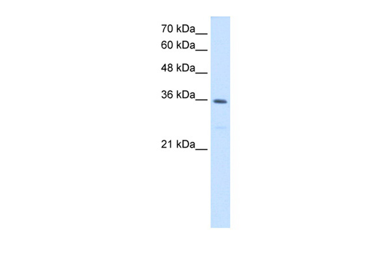 Antibody used in WB on Human HepG2 at 1.25 ug/ml.