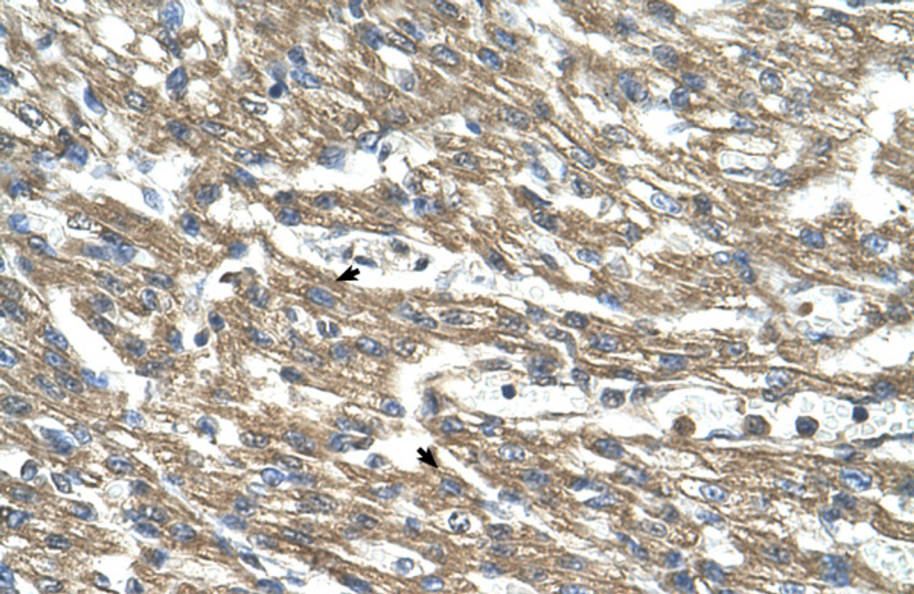 Antibody used in IHC on Human Heart.