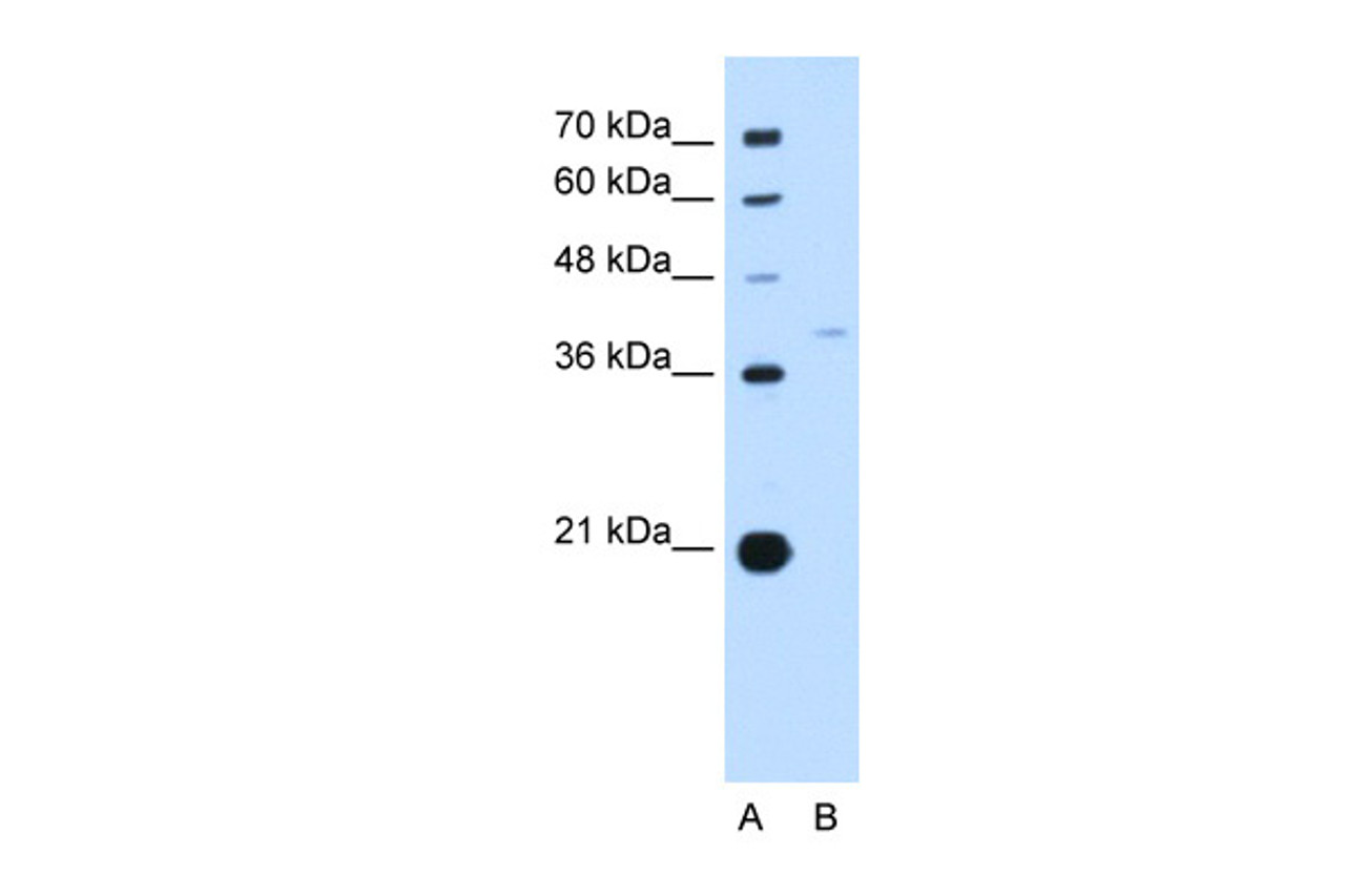 Antibody used in WB on Human HepG2 cells at 0.2-1 ug/ml.