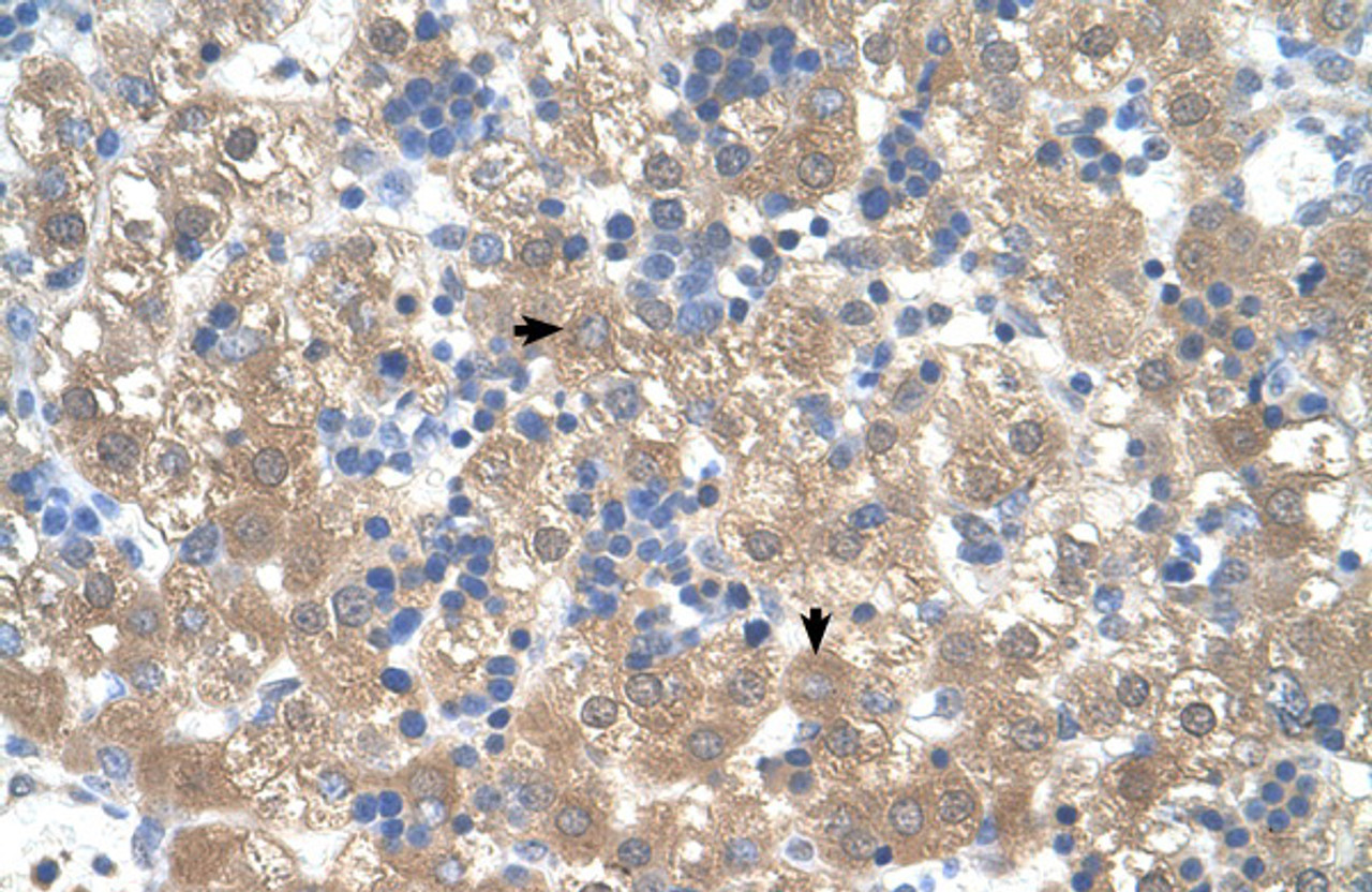 Antibody used in IHC on Human Liver.