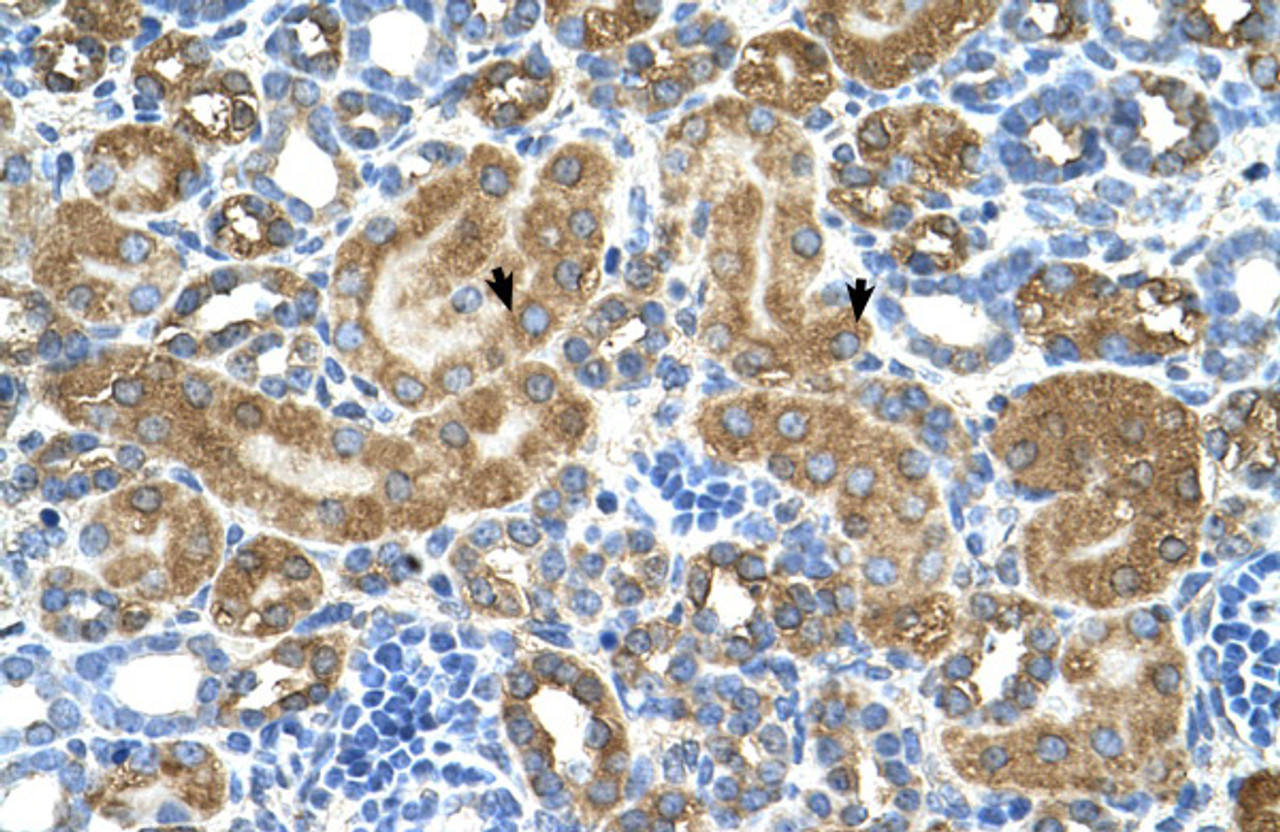 Antibody used in IHC on Human kidney.