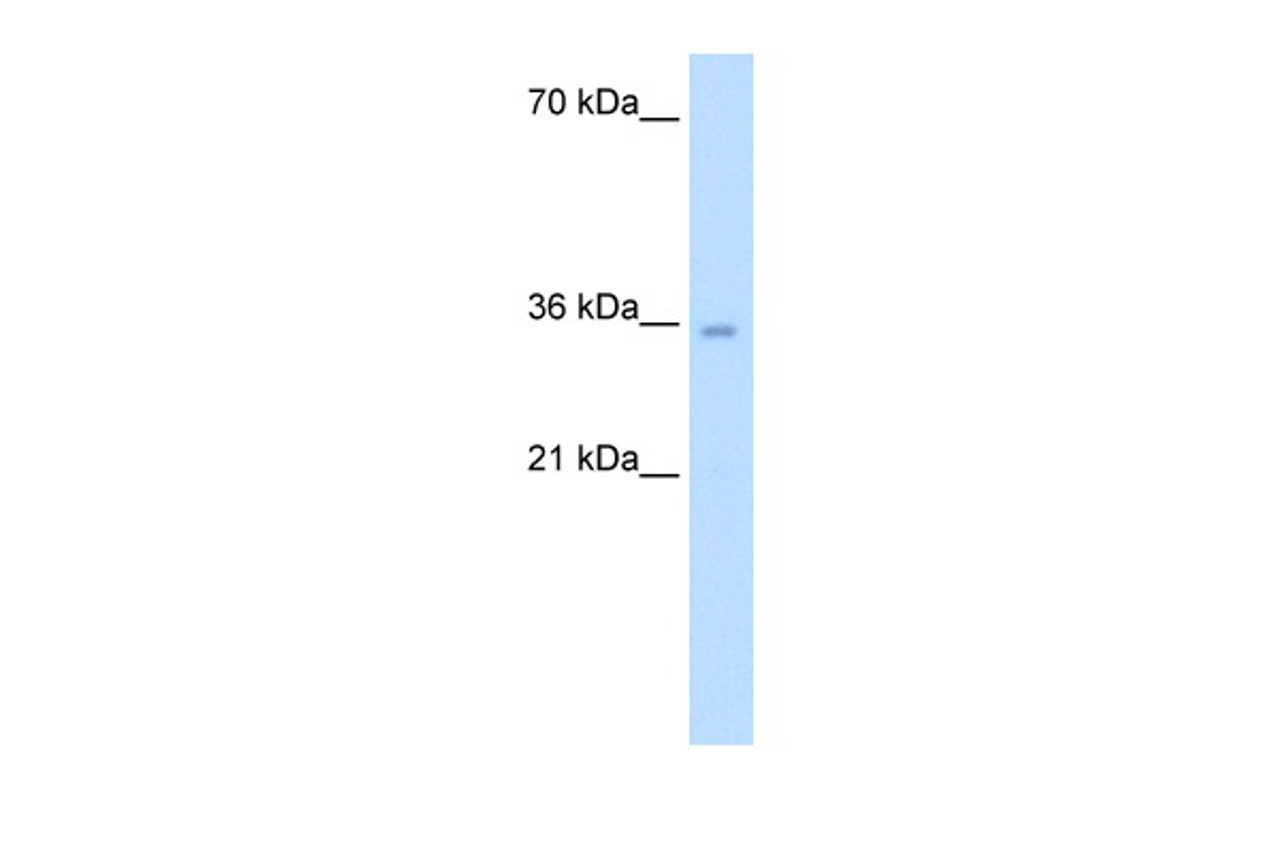 Antibody used in WB on Human Jurkat 5.0 ug/ml.