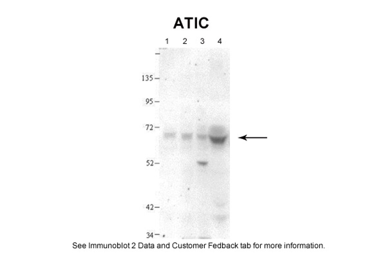 Antibody used in WB on Human, Hamster at 1:800.