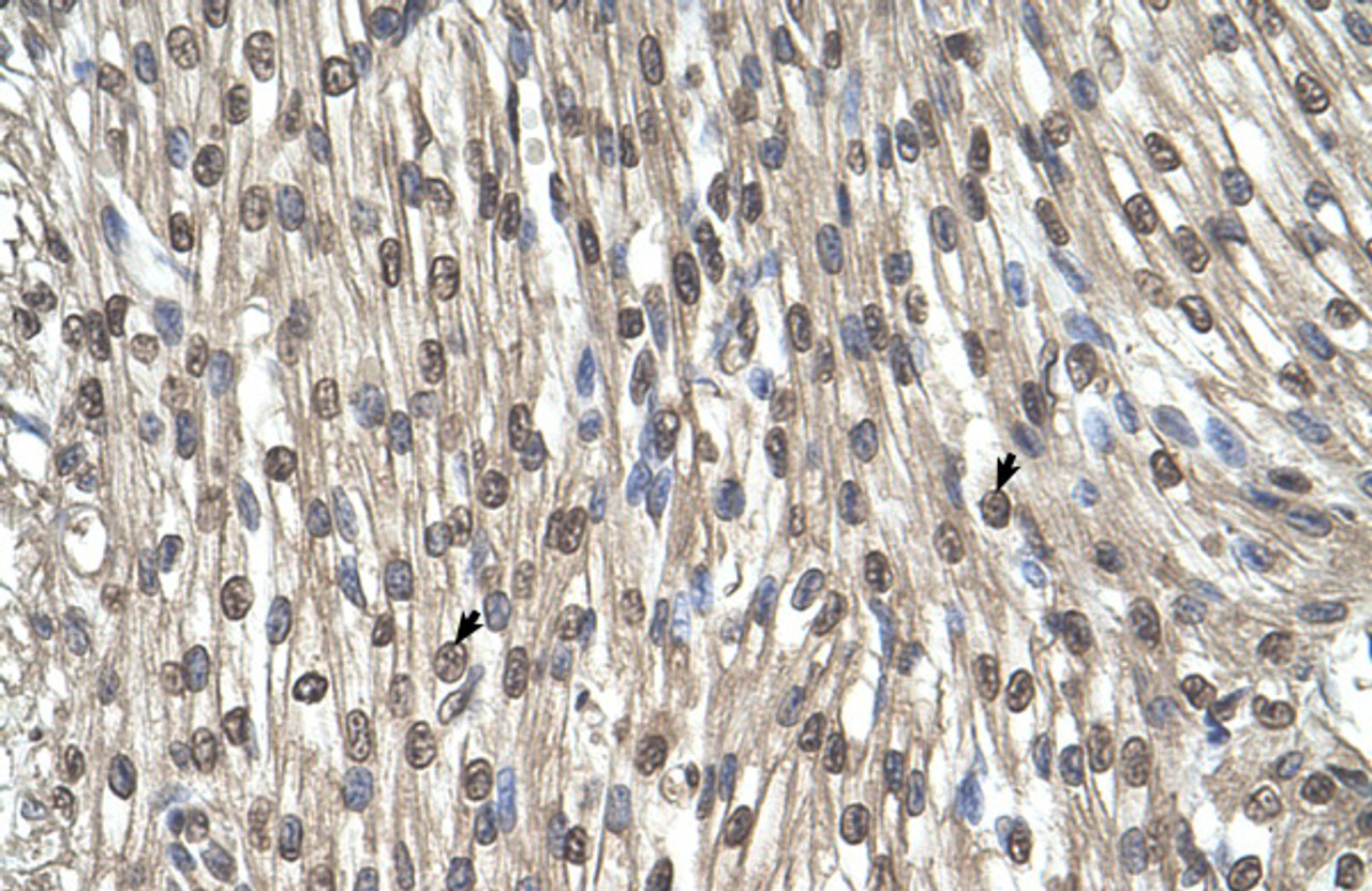 Antibody used in IHC on Human Heart.