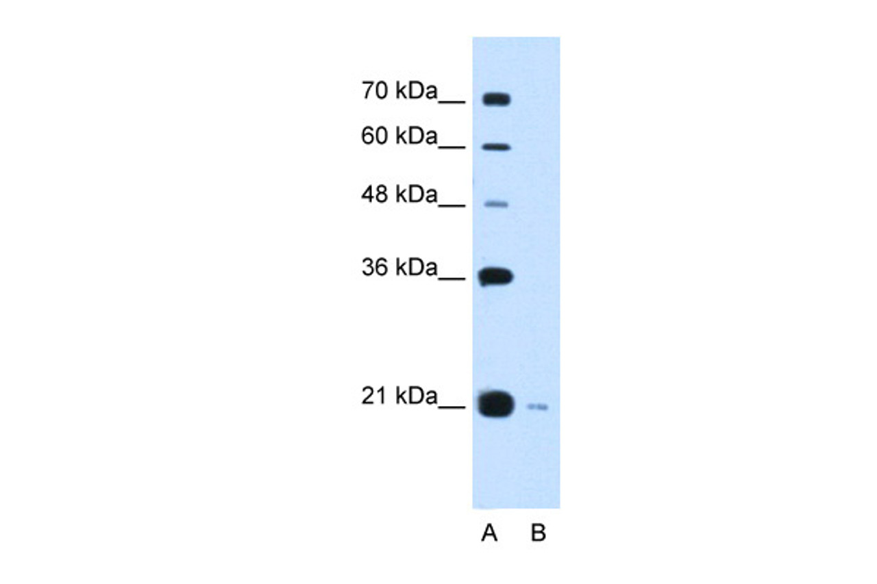 Antibody used in WB on Human HepG2 at 0.2-1 ug/ml.