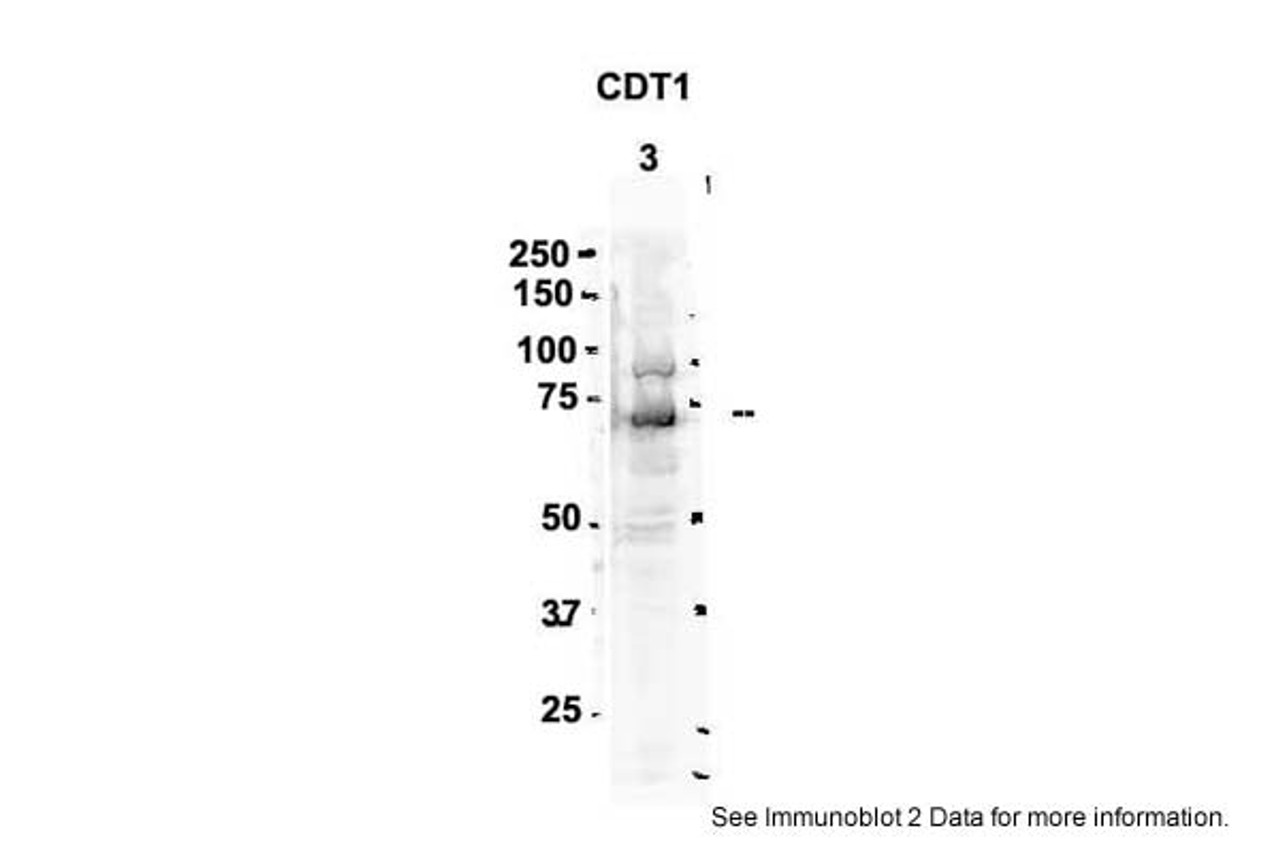 Antibody used in WB on Rat brain at 2 ug/ml.
