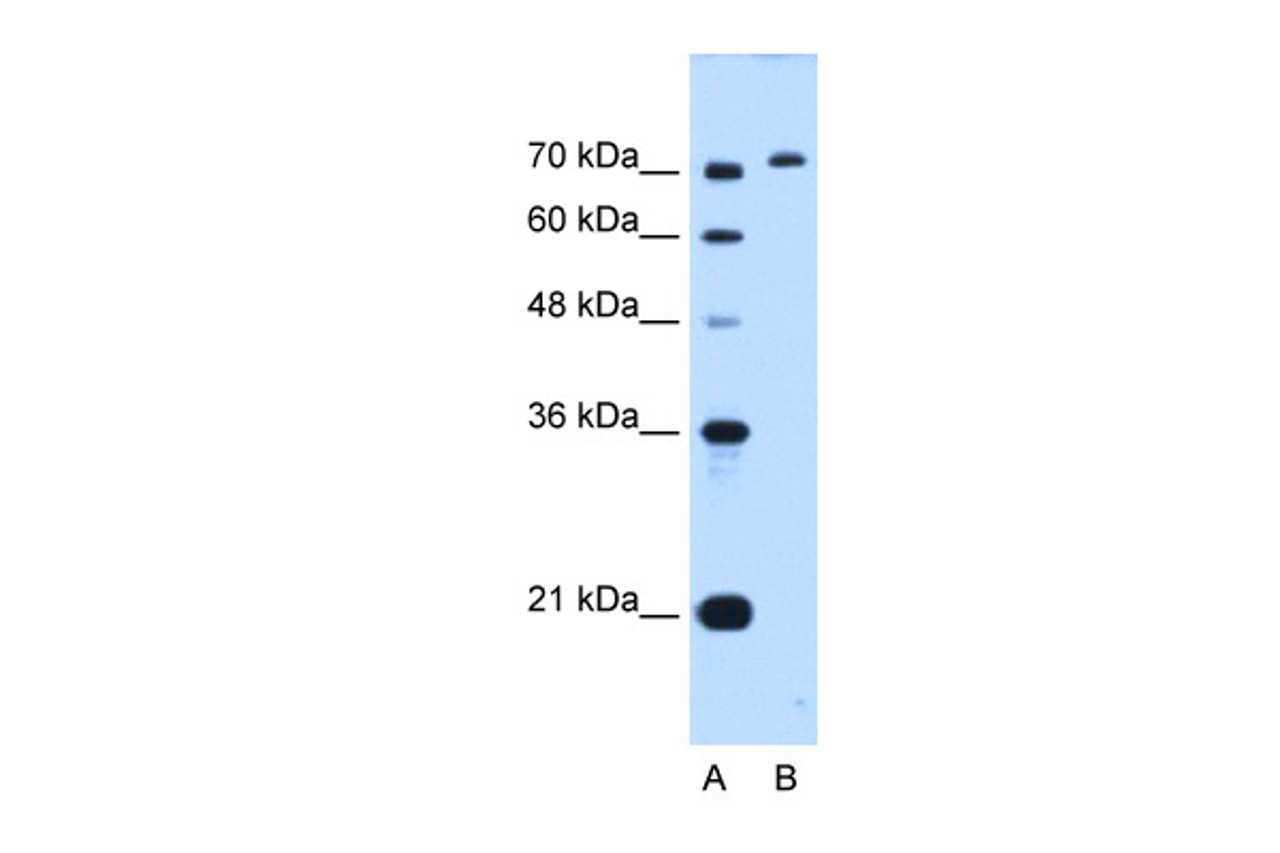 Antibody used in WB on Human HepG2 at 0.2-1 ug/ml.