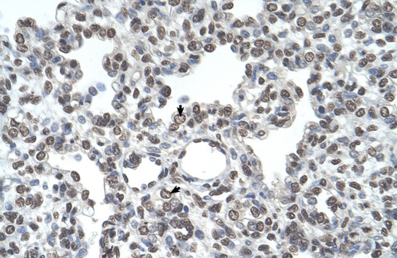 Antibody used in IHC on Human Lung.