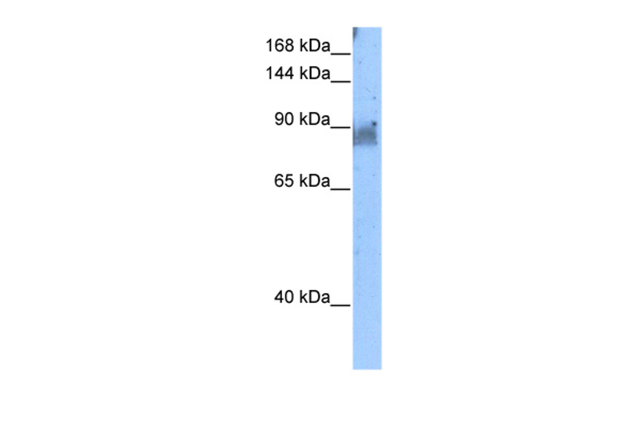 Antibody used in WB on Transfected 293T at 5.0 ug/ml.