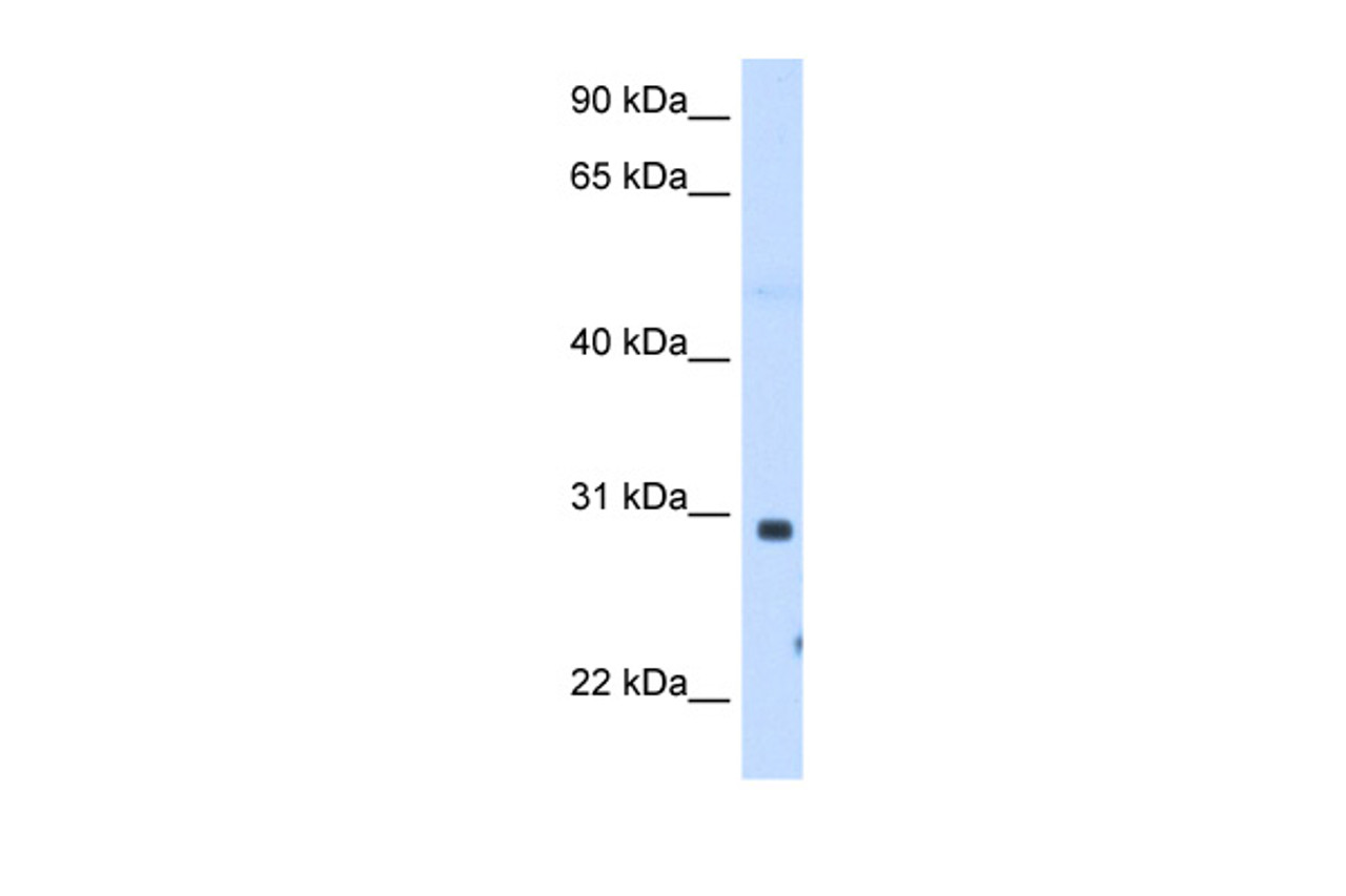 Antibody used in WB on Human Muscle at 1.25 ug/ml.