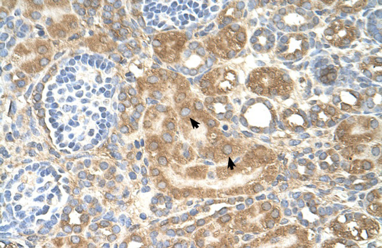 Antibody used in IHC on Human kidney.