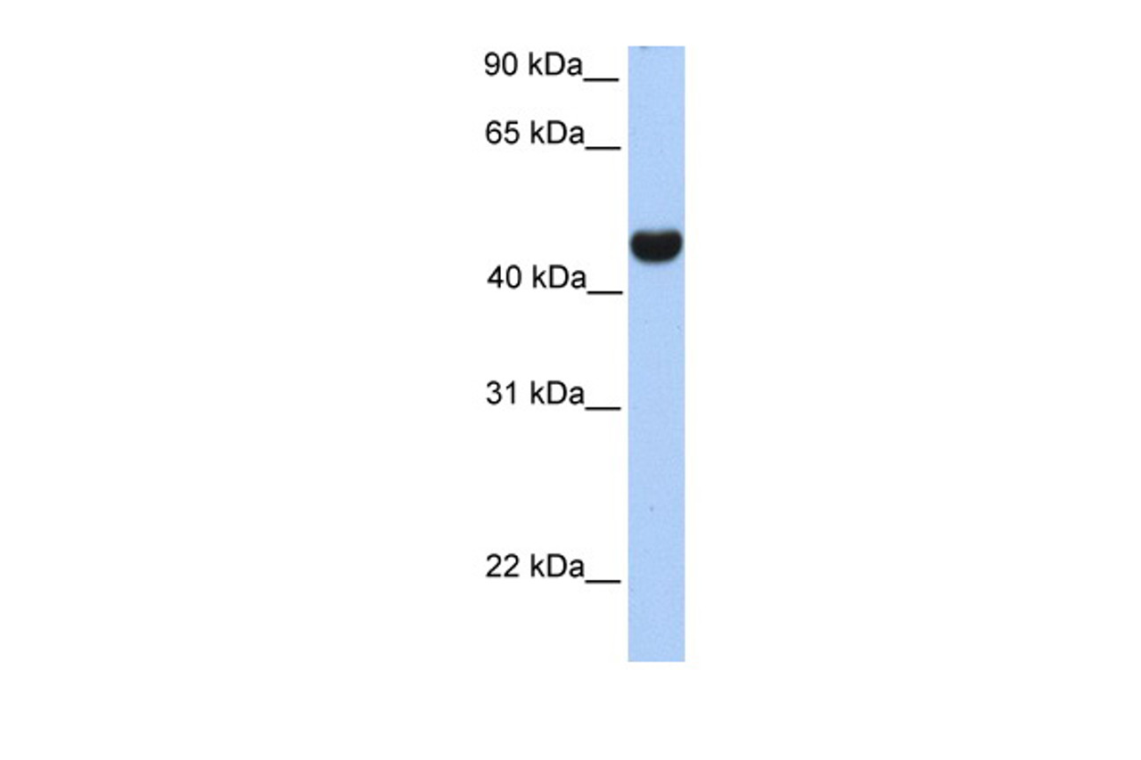 Antibody used in WB on Human Brain at 0.2-1 ug/ml.