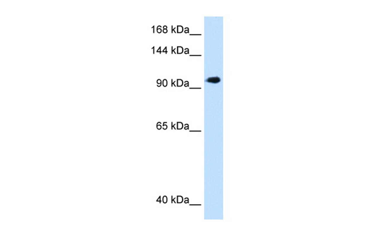 Antibody used in WB on Human HepG2 at 1.25 ug/ml.