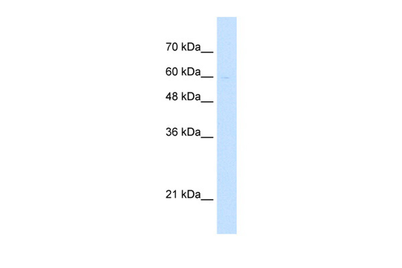 Antibody used in WB on Human Jurkat cells at 5.0 ug/ml.