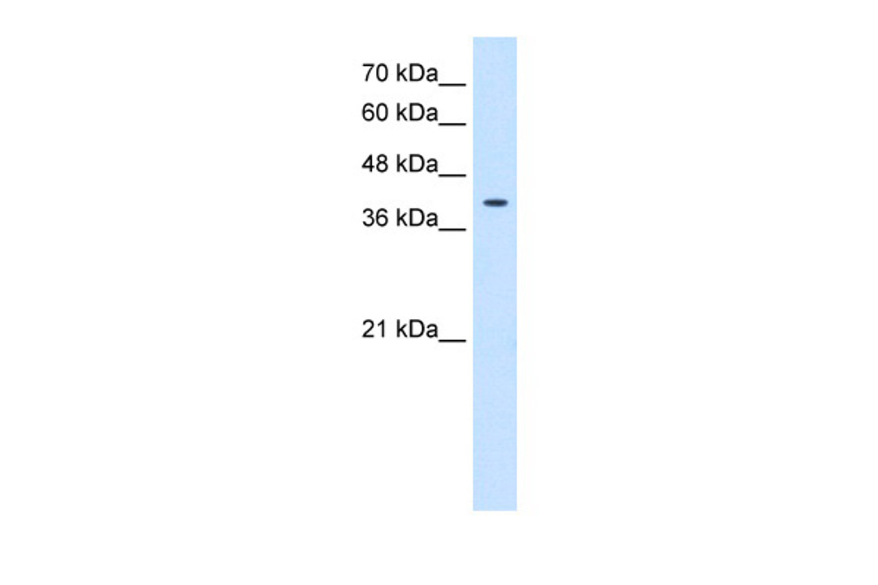 Antibody used in WB on Human HepG2 at 0.2-1 ug/ml.