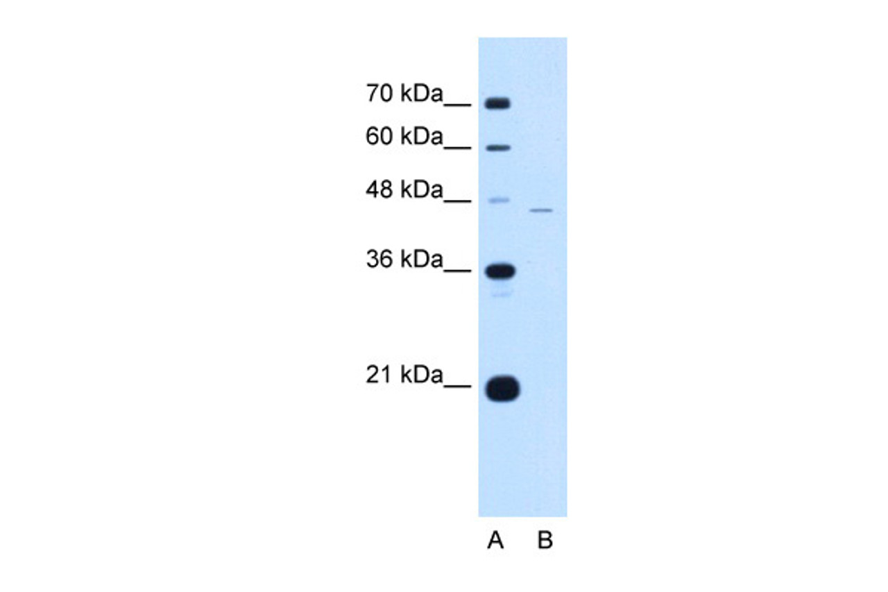 Antibody used in WB on Human Jurkat 0.2-1 ug/ml.