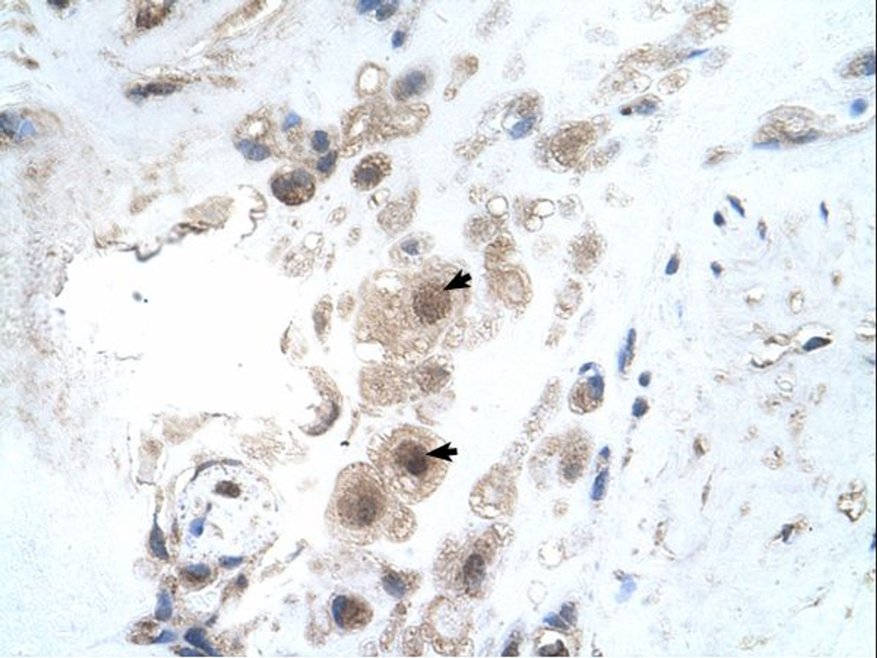 Antibody used in IHC on Human Placenta.