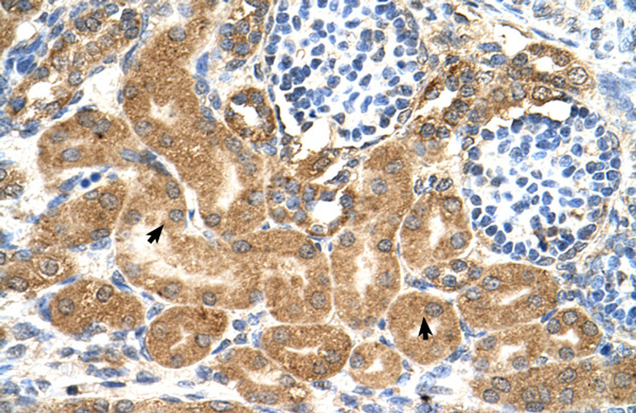 Antibody used in IHC on Human kidney.