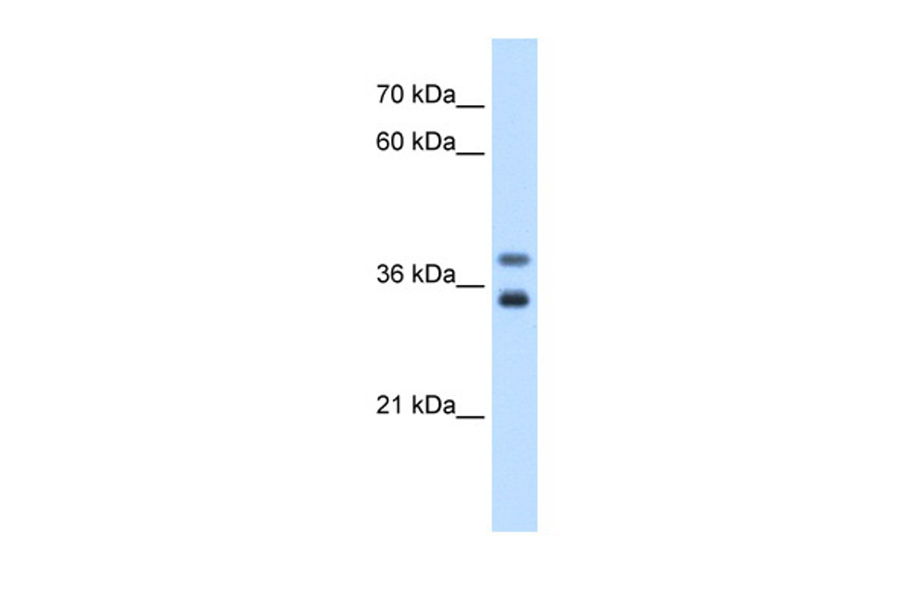 Antibody used in WB on Human Jurkat 0.2-1 ug/ml.