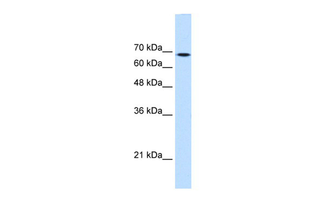 Antibody used in WB on Human HepG2 at 0.2-1 ug/ml.