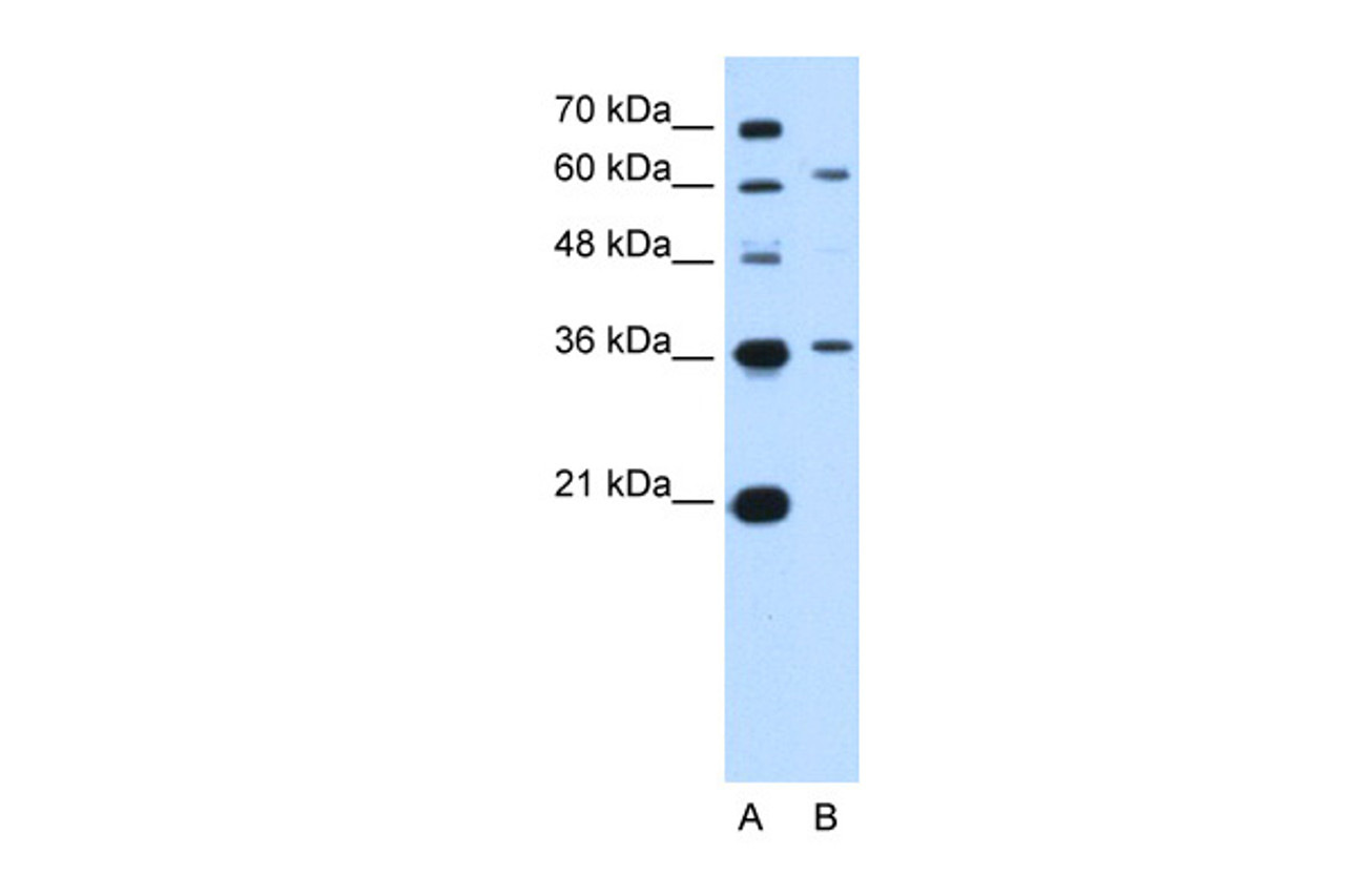 Antibody used in WB on Human Jurkat 5.0 ug/ml.