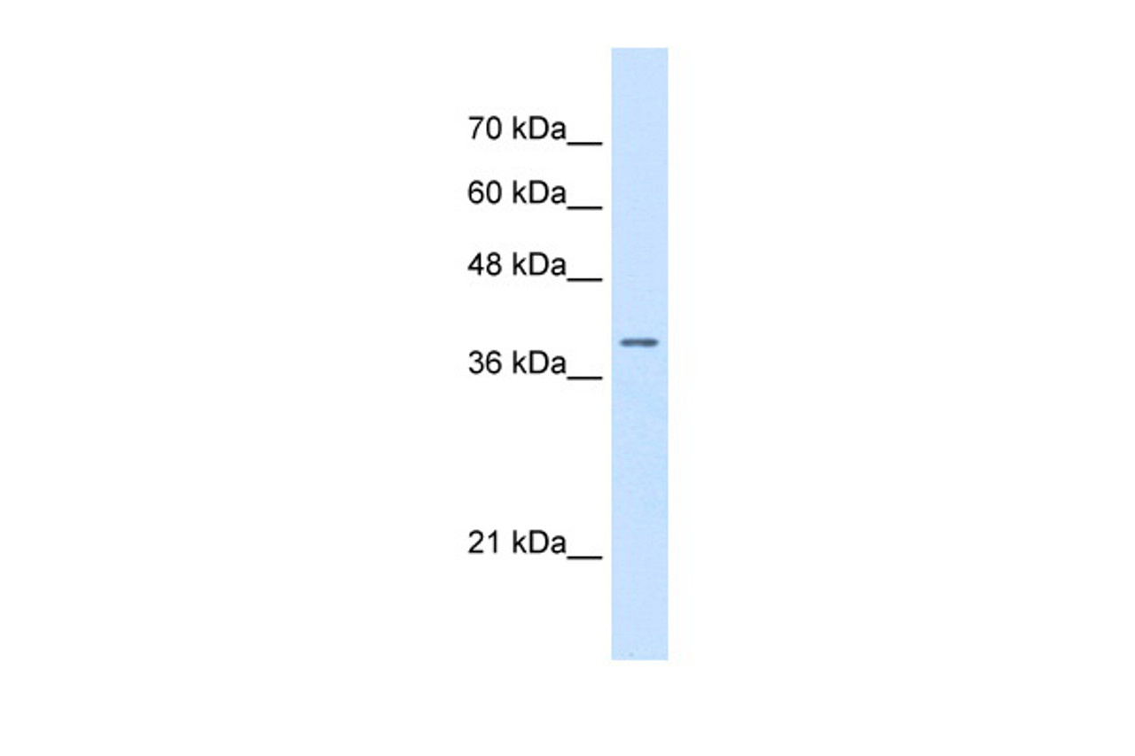 Antibody used in WB on Human HepG2 at 0.5 ug/ml.