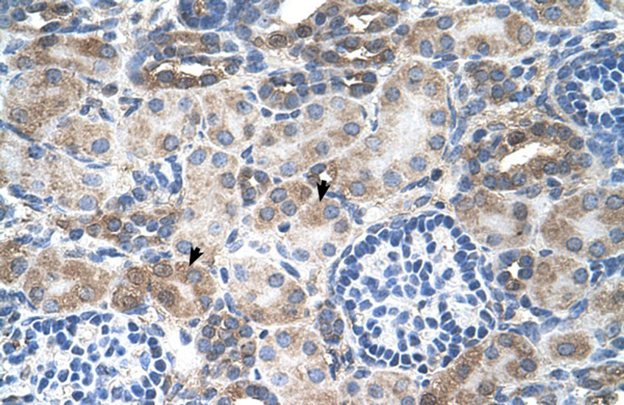 Antibody used in IHC on Human kidney.