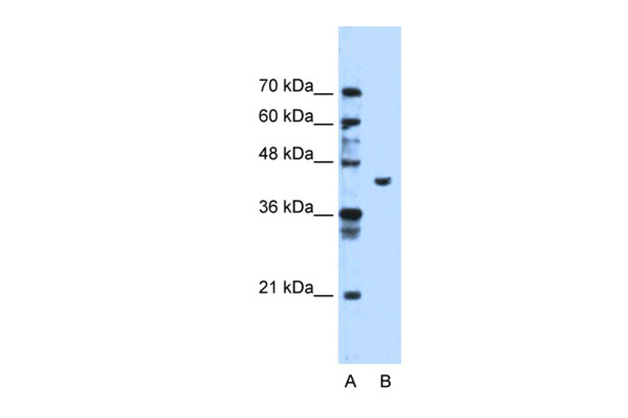 Antibody used in WB on Human HepG2 at 1.25 ug/ml.