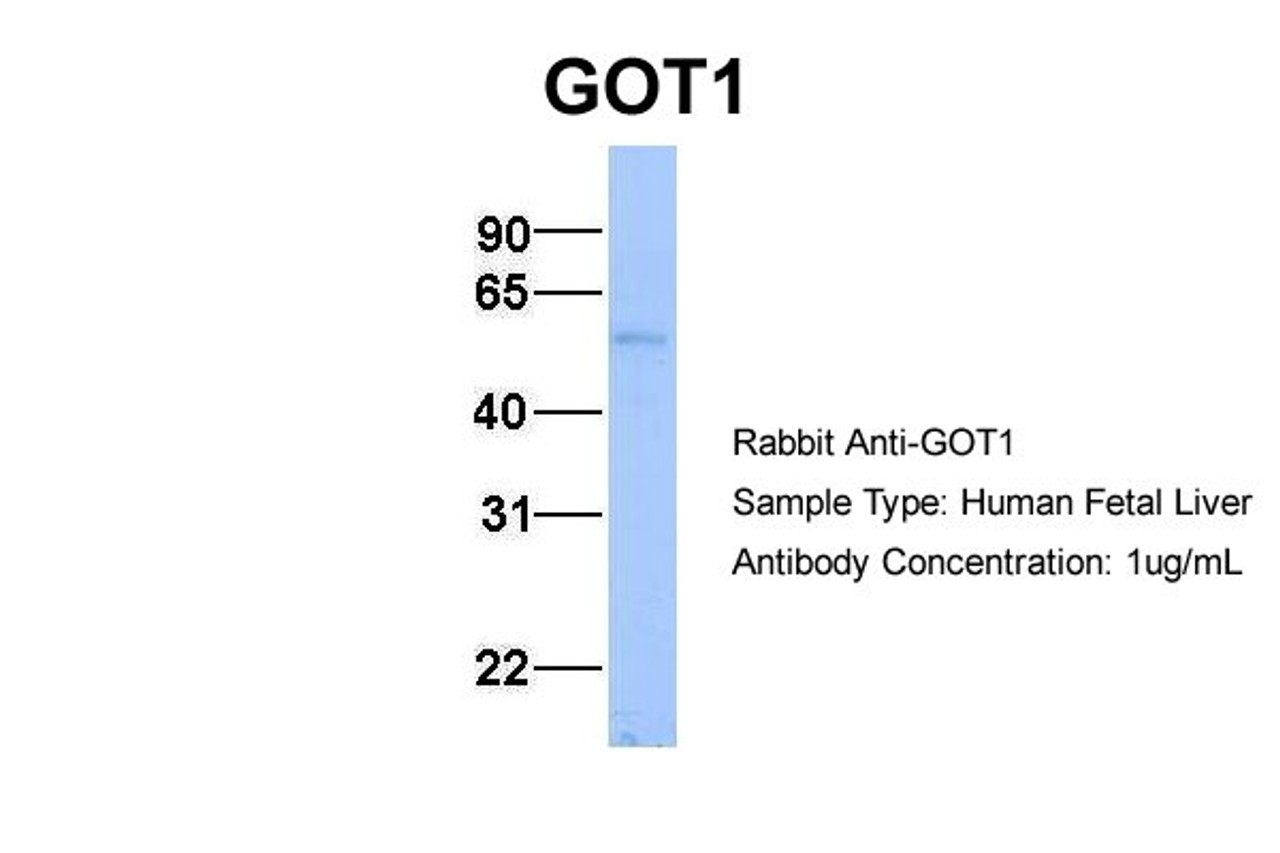 Antibody used in WB on Hum. Fetal Liver at 1 ug/ml.