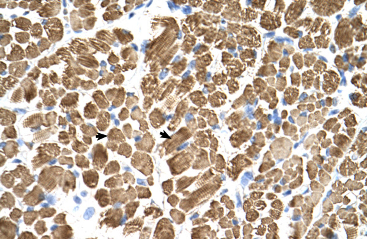 Antibody used in IHC on Human Muscle.