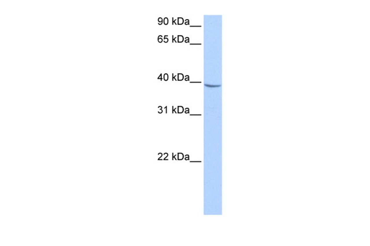 Antibody used in WB on Human HepG2 at 0.2-1 ug/ml.