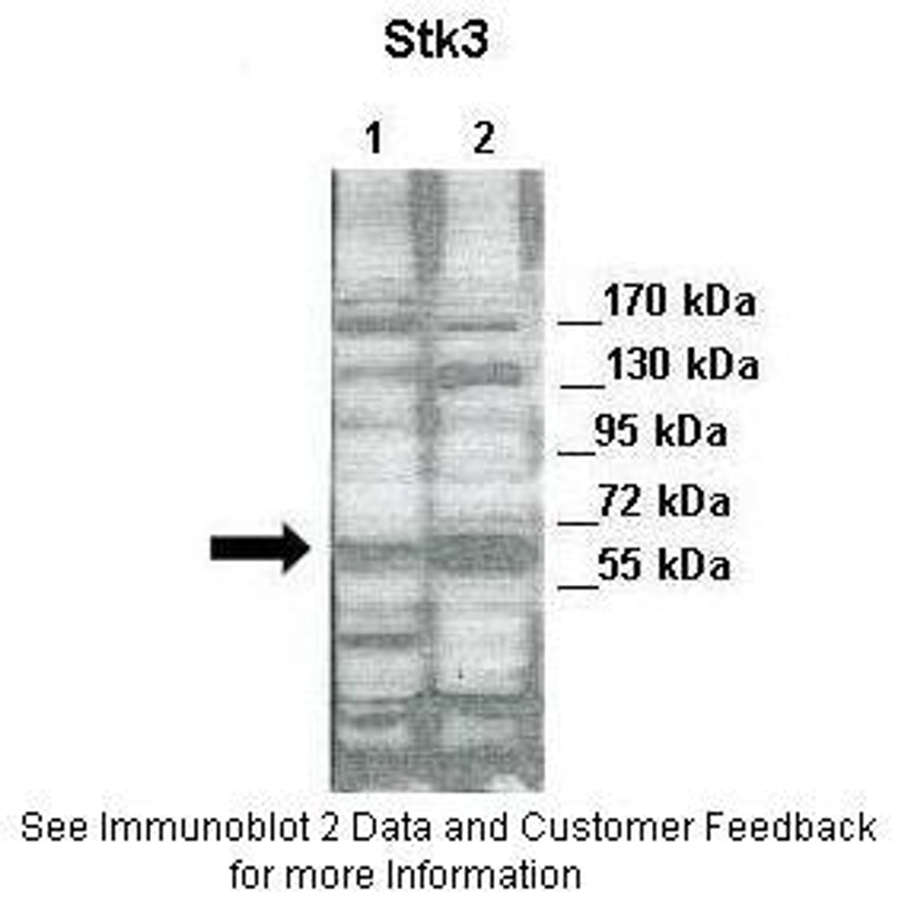 Antibody used in WB on Human cell lines at: 1:2000 (Lane 1: 30ug of HeLa cell lysate, Lane 2: 30ug of 293T cell lysate) .