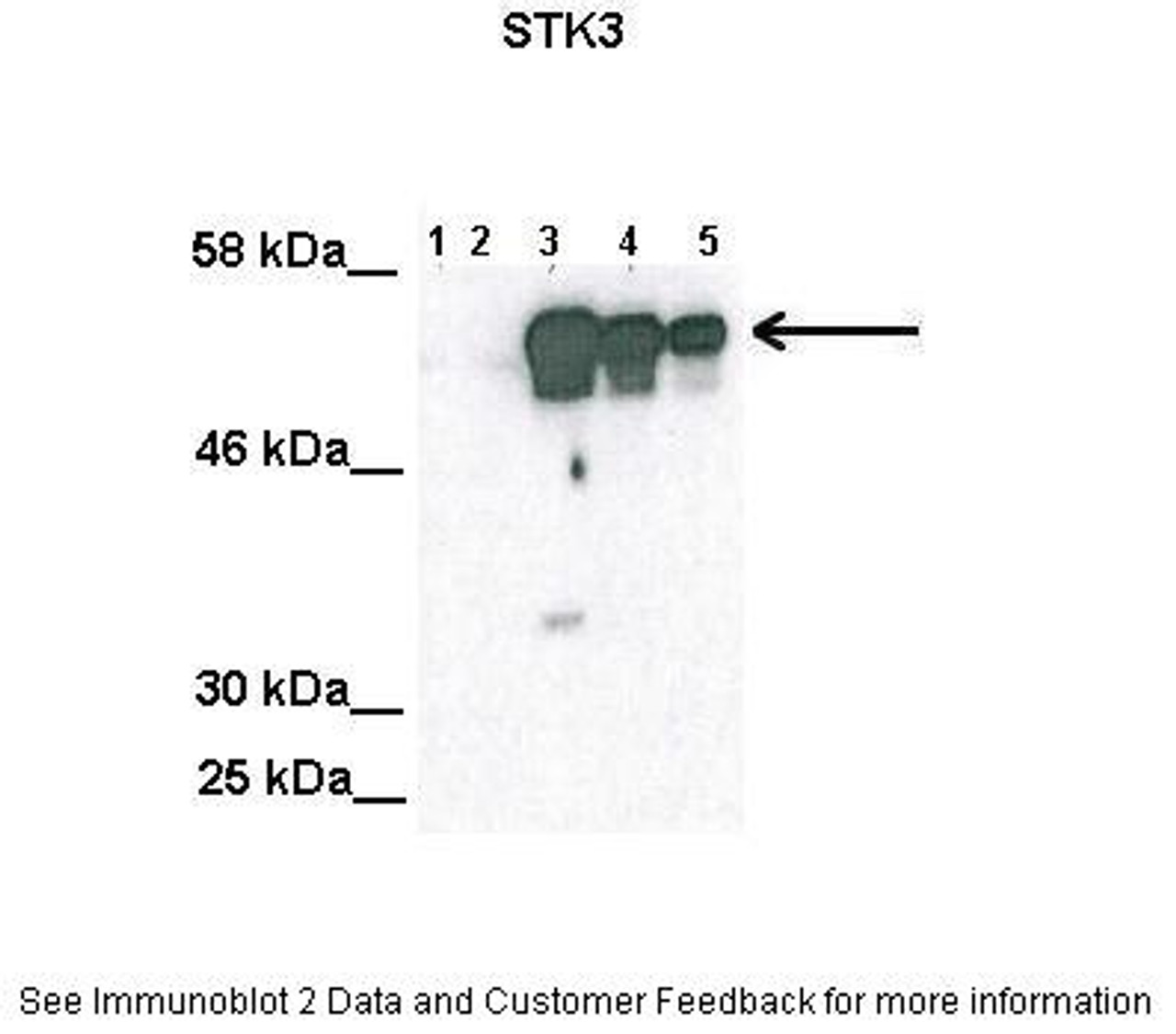 Antibody used in WB on transfected Cos-7 at: 1:2000 (Lane1: 100ug untransfected COS-7 lysate, Lane2: 100ug mock transfected Cos-7 lysate, Lane3: 100ug STK3 transfected Cos-7 lysate, Lane4: 50 ug STK3 transfected Cos-7 lysate, Lane5: 25 ug STK3 transfected Cos-7 lysate) .